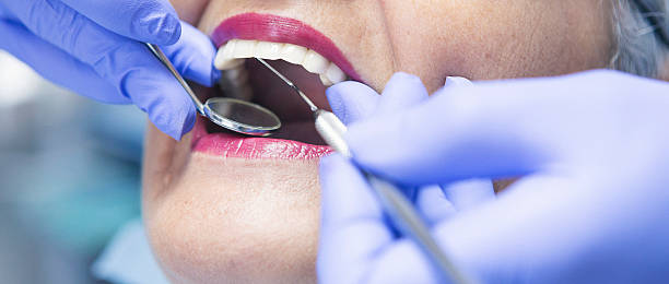 Best Emergency Root Canal Treatment in West Wareham, MA